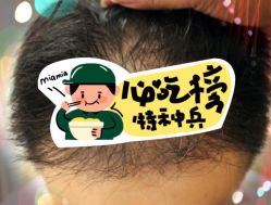 -大麦微针植发全国连锁