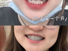 -极光口腔·矫正种植修复(锦江店)