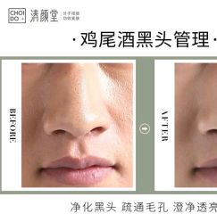 -清颜堂丨分子祛痘·功效美肤