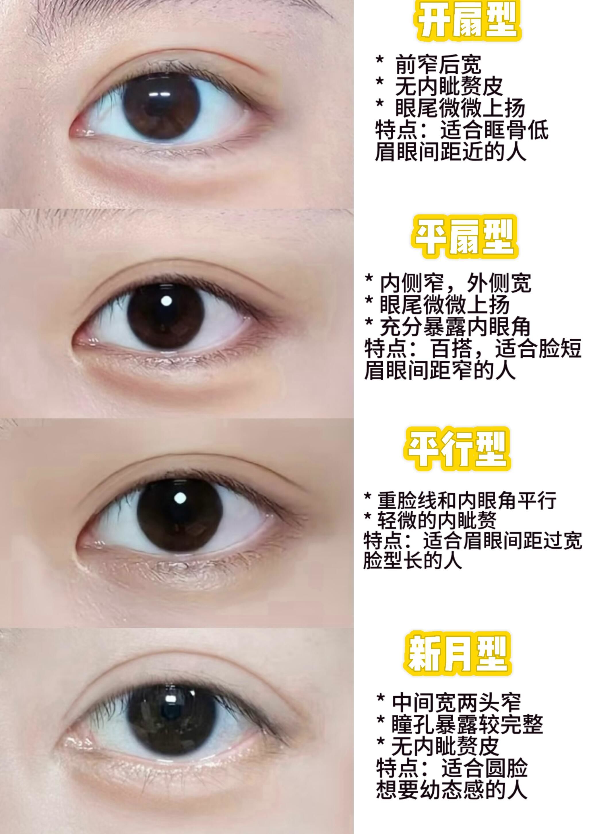 1篇笔记告诉你,自己适合哪几种双眼皮