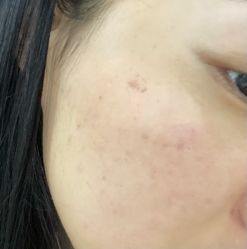 点击看大图 体验后-成都艾特他整形外科医院