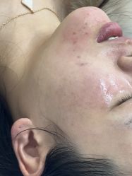 -长沙雅美医疗美容医院