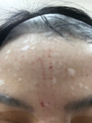 -深圳春天阳光医院·轮廓抗衰中心