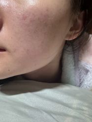 -演员的秘密·皮肤管理