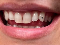 -Dr.Z dental仁康种植矫正中心