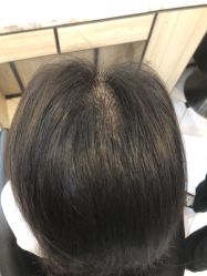 -HAIR CORNER