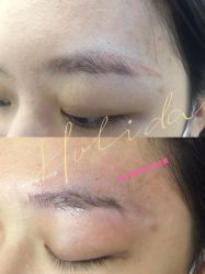 -郡艺医疗美容·微整·眼鼻吸脂