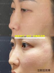 -北京米扬丽格医疗美容·联合丽格鼻整形中心