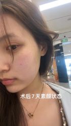 -苏州维多利亚美容医院