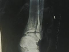 -中国人民解放军总医院