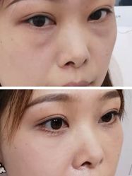 -深圳艺星医疗美容医院