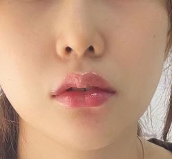 -东剑医学美容·注射美学中心