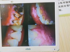 -爱牙联合口腔(门诊报销 海云庵店)