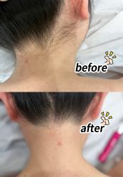 -HEYAN荷妍专业脱毛连锁机构