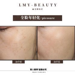 -丽美妍医疗美容·皮秒·立体分层抗衰
