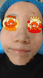 -斐研美医疗美容·眼周抗衰中心