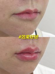 -Yestar艺星医疗美容医院