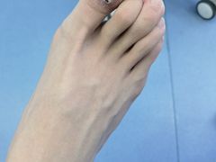 -Andrew指甲专科灰指甲·甲沟炎矫正·3D步态矫形鞋垫定制(浦三路店)