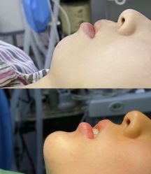 -郡艺医疗美容·微整·眼鼻吸脂