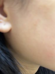 -美莱医疗美容医院