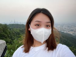 体验后-广州健丽·去眼袋医疗美容机构