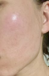 -联合丽格·张菡丽格医疗美容