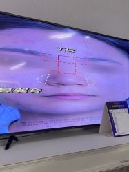 -广州美莱医疗美容医院