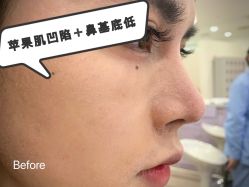 -Yestar宁波艺星整形医院