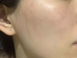 点击看大图 -亿美医疗美容·半岛大超炮官方授权店