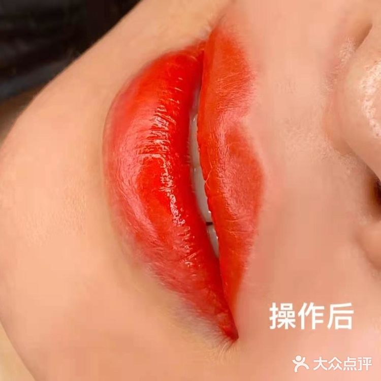 纹唇了，前后对比差别好大！[胜利]