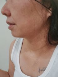 -海涛医疗美容·面部抗衰·注射美鼻