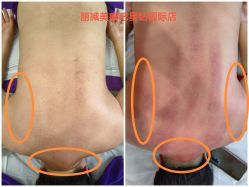 -丽减美瘦吧·减肥瘦身