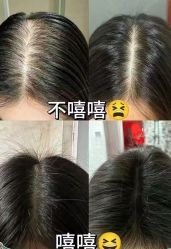 -润复丝·泽发防脱头皮管理