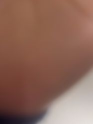 -广东韩妃整形外科医院