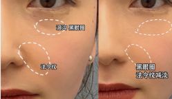 -安徽合肥韩美整形外科医院