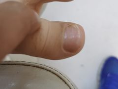 -新甲连锁灰指甲·甲沟炎·鸡眼(黑龙江路店)