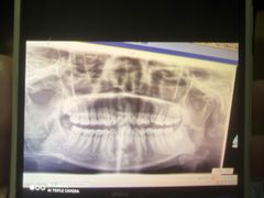 -浙江省中医院(湖滨院区)