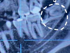 -爱贝口腔·牙周诊疗·种植修复中心