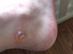 -无锡市第二人民医院(南院)