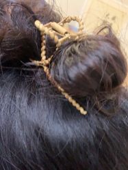 点击看大图 体验前-熙朵美学植发连锁