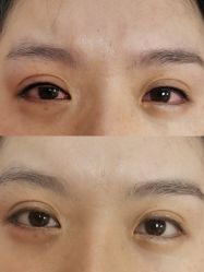 体验前-美莱医学美容医院