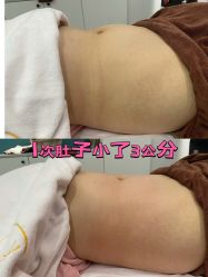 -Lily纤美·科技减脂中心