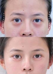 点击看大图 -Yestar艺星医疗美容医院
