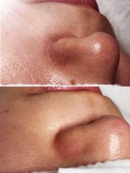 -苑苑vbeauty科技美容SPA