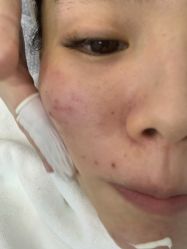 -悟空祛痘·诺奖技术专业店