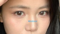 -天津健丽·去眼袋医疗美容机构