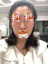 体验后-坤如玛丽·医疗美容中心