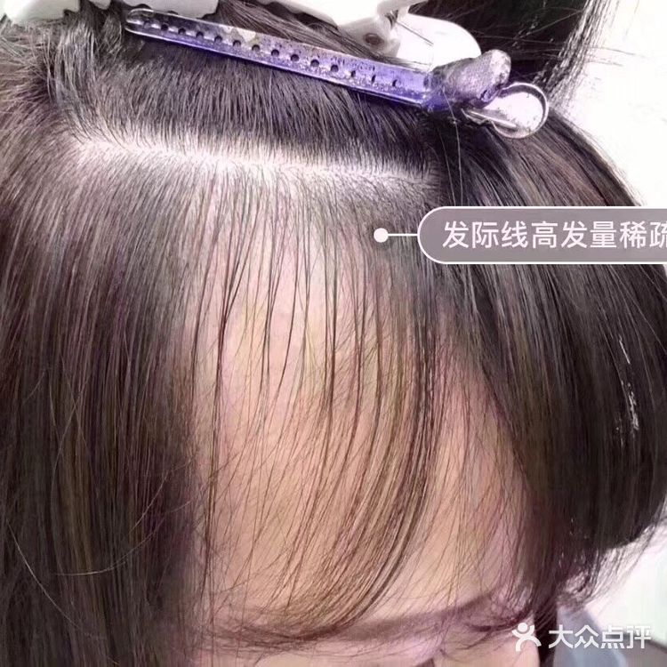 物理接发 增量 减龄