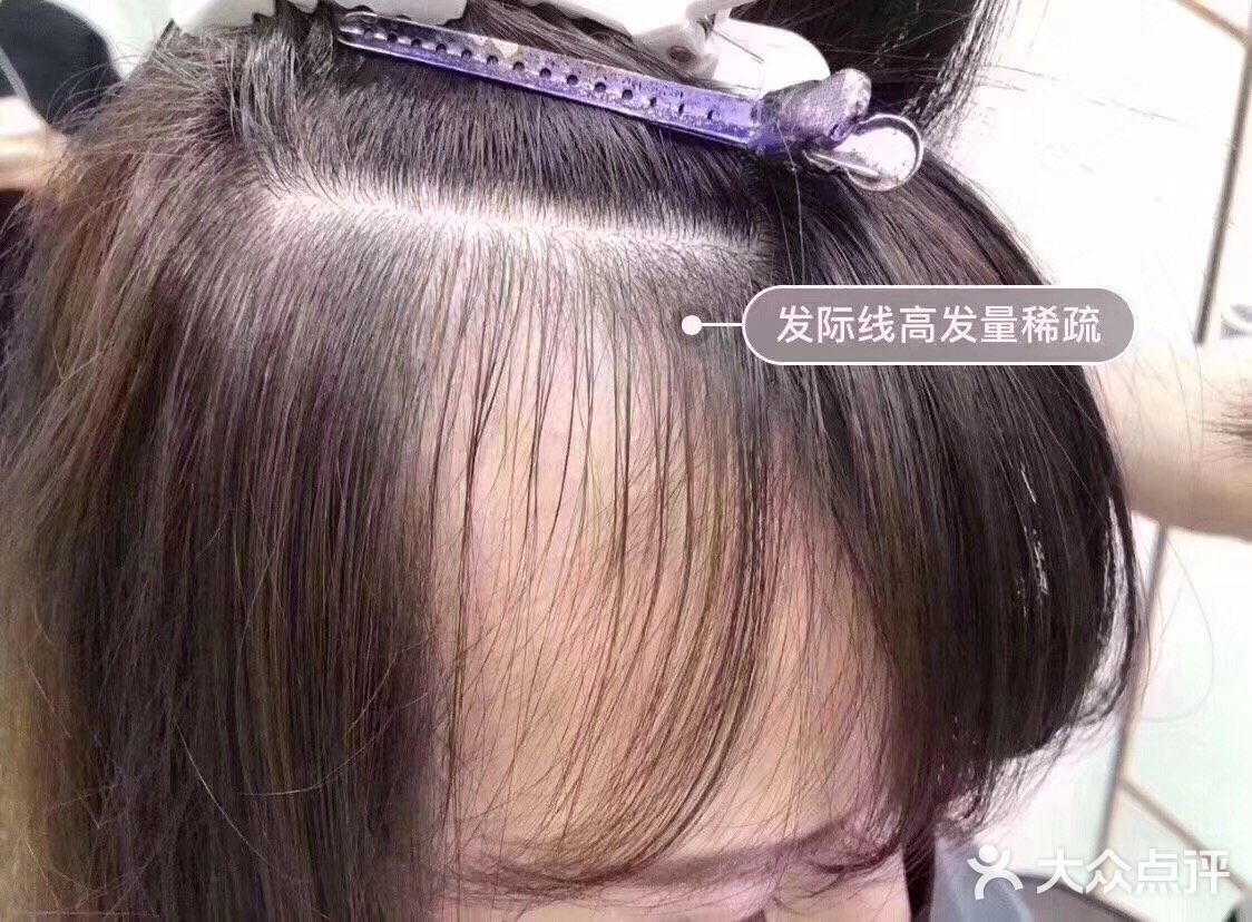 物理接发 增量 减龄