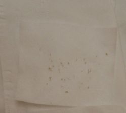-苑苑vbeauty科技美容SPA